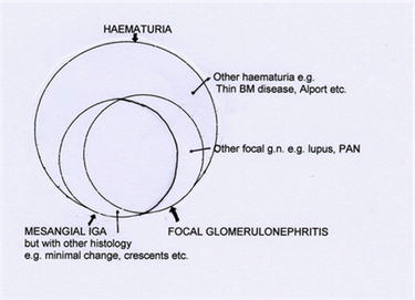 The background to IgA nephropathy: an intersection of paths